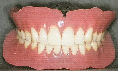 「差し歯・入れ歯」専門医による診療を受けてみませんか？02