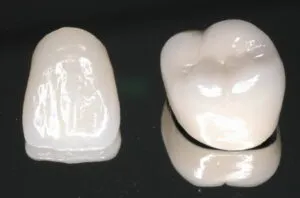 「差し歯・入れ歯」専門医による診療を受けてみませんか？01