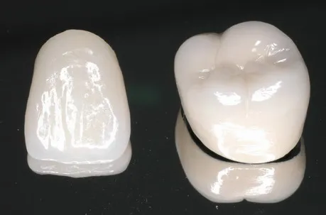 「差し歯・入れ歯」専門医による診療を受けてみませんか？01