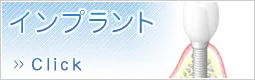 インプラント