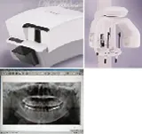 体に優しく、説明がわかりやすいＸ線撮影